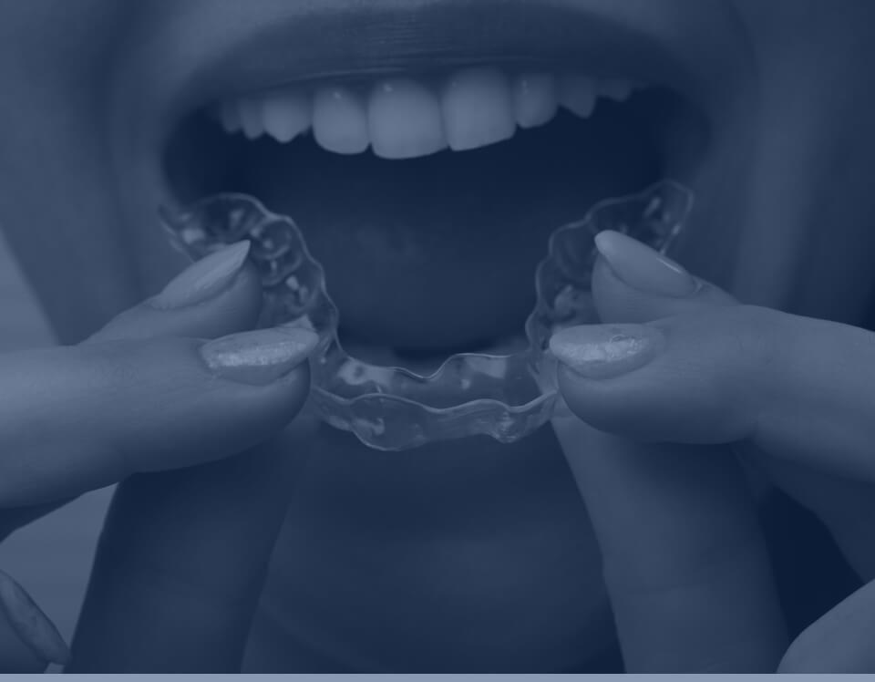 A woman holding an upper Invisalign aligner in front of her open mouth.